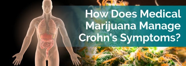 chrons disease managing symptoms with cannabis