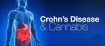 Chrons disease and cannabis