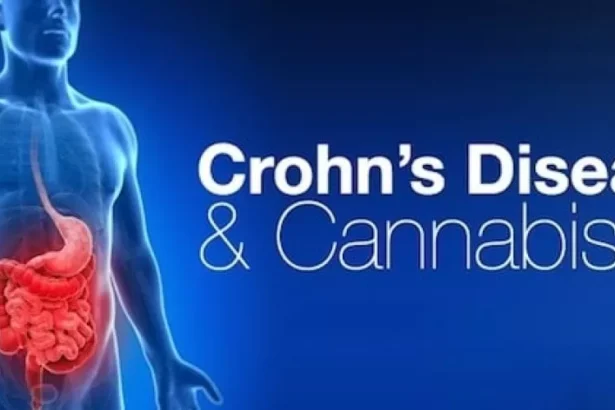 Chrons disease and cannabis