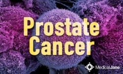 prostate cancer cbd 